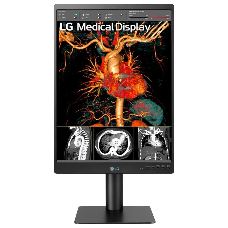 21.3インチ 3MP 診断用モニター | LGエレクトロニクス 21HQ513D-B
