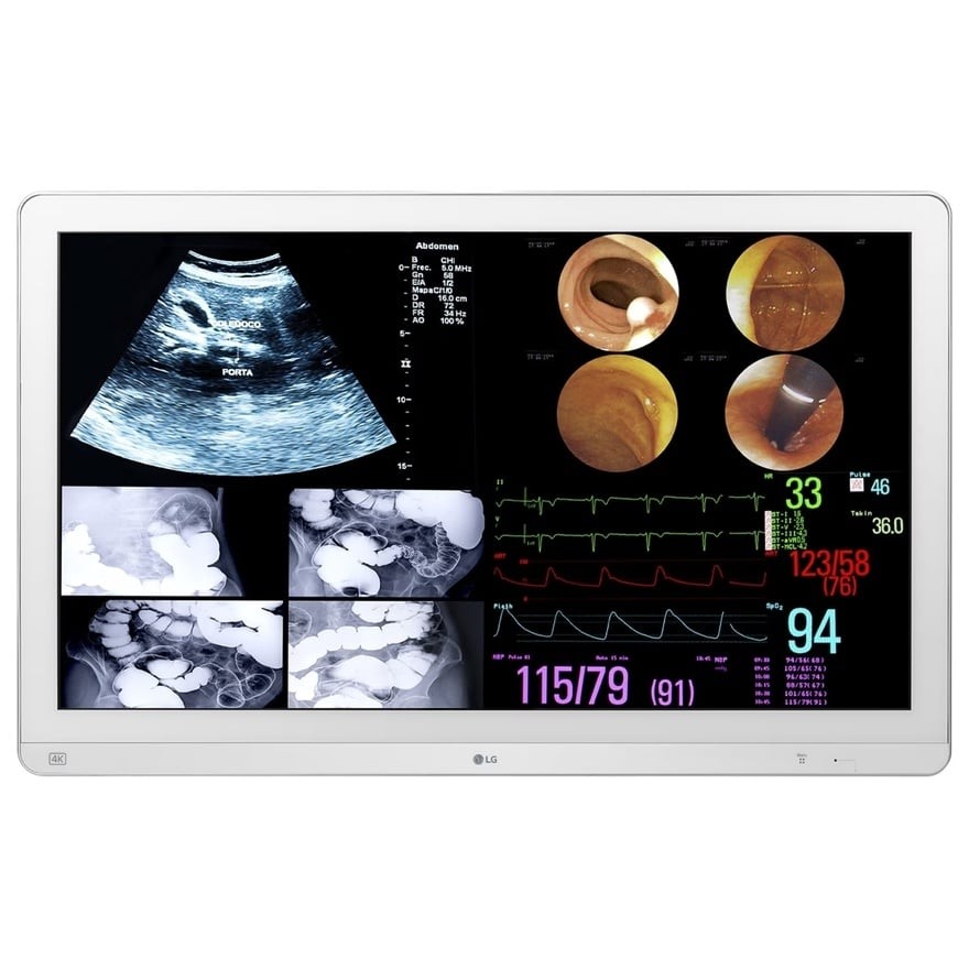 31.5インチ 8MP 手術用モニター | LGエレクトロニクス 32HL714S-W